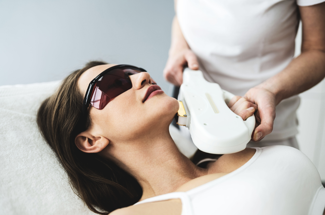 IPL-Anwendung im Gesicht mit Schutzbrille