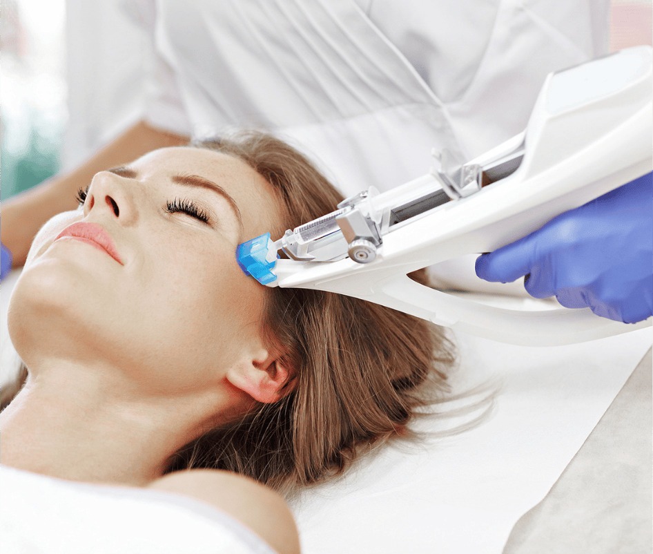 Mesotherapie-Anwendung im Gesicht
